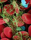 Intervention & Prevention: Keeping Current with Acute Coronary Syndrome - A Journal Club for Primary Care<br>(Issue #1)