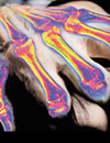 Joint Decisions: Optimizing the Management of Rheumatoid Arthritis