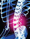Pharmacologic Considerations for Low Back Pain Treatment: Perspectives on Skeletal Muscle Relaxants