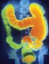 Improving Clinical Proficiency: Enhancing Care for Your IBS Patients