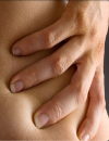 Case Study 3: Patient With Cervical Sprain and Low Back Pain Following a Motor Vehicle Accident