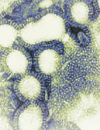 Vaccinating Schoolchildren:<br>Next Step Forward in the Battle Against Influenza?