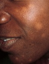 Dermatology Clinic from <i>The Clinical Advisor</i> (Jan 2010)