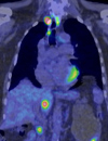 Carcinoma of Unknown PrimaryChanging Paradigm in the Era of Molecular Profiling