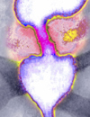 Clinical Benefits and Costs of New Treatments for Advanced Colorectal Cancer