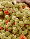Survival after HighDose Therapy and Autologous Transplantation in Chemoresistant HL