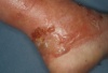 Dermatology Clinic from <i>The Clinical Advisor </i>(February 2010)