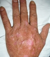 Dermatology Clinic from <i>The Clinical Advisor</i> (March 2010)