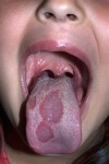 Oral Pathology for the Primary Care Clinician