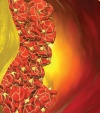 VTE in Cancer Patients: A Case-Based Approach to Risk <br>Assessment and Management