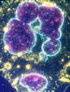 New Cancer Therapies in 2009: A Review for the Oncology Nurse
