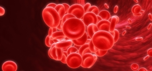Preventing VTE in the Community: Best Practices for the Establishment & Management of an Outpatient VTE Prevention Program