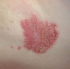 Dermatology Clinic from <i>The Clinical Advisor</i> (July 2010)