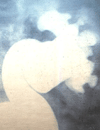 Febrile UTI and Renal Scarring 