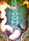 Digestive Disease Week 2010