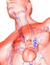 Intervention  Prevention Keeping Current with Acute Coronary Syndrome  Journal Club Issue 10
