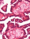 Classifying Histologic Subtypes of Renal Cell Carcinoma