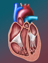 Percutaneous Closure of Atrial Septal Abnormalities Including Patent Foramen Ovale for Cryptogenic Stroke