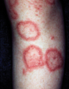 Lupus and the autoimmune process The view from 2012