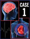 Case 1: A 75-Year-Old Woman With Atrial Fibrillation and Dental Problems