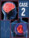 Case 2: A 78-Year-Old Man With Rapid Pulse and Poorly Controlled Hypertension