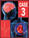 Case 3: An 80-Year-Old Woman with Atrial Fibrillation and Multiple Cardiovascular Risk Factors
