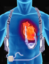 Day to Day Management of Heart Failure Patients by the Primary Care Physician