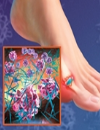 Clinical Challenges and Renal Considerations in Managing Gout Part II