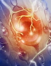 Ask the Expert: Improving the Diagnosis and Management of Fibromyalgia for Physician Assistants