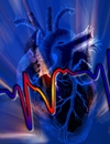 Intervention  Prevention Keeping Current with Acute Coronary Syndrome Journal Club Issue 16