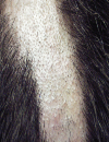 Trunk rashes Depigmentation on the chest and nail folds Recentonset hair loss