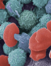 Leukemia Understanding its types and treatments