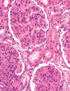 An Update on the Management of Lupus Nephritis