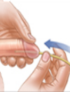 Part I Assessment and Diagnostic Strategies for Neurogenic Bladder