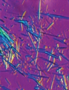Clinical Challenges and Renal Considerations in Managing Gout: Part I