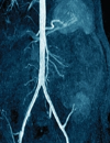 The Management of Patients After Renal Transplantation