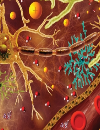 Hyponatremia: An Update on the Management of SIADH