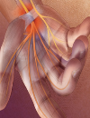 Carpal tunnel syndrome Symptoms, diagnosis, and treatment options Medical and surgical management of peripheral arterial disease
