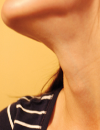 Evaluating a neck mass Management of low back pain