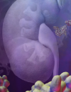The pathophysiology, diagnosis, and management of proteinuria Updated guidelines for Alzheimer disease diagnosis