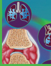 Systemic Inflammation in Rheumatoid Arthritis: Understanding the Effects of RA Outside the Joints