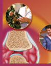 The Importance of Monitoring and Managing Quality of Life in RA