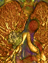 Understanding the impact of disparities on cancer care