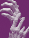 Advancing the Art and Science of Psoriasis and Psoriatic Arthritis Management