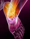 A 58 Year-Old Female Complains of Joint Pain and Fatigue