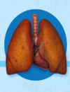 Non-Small Cell Lung Cancer: Molecular Targets and Emerging Options for Care