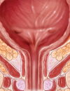 LUTS A practical guide to alleviating lower urinary tract symptoms Assessment, diagnosis, and treatment of developmental dysplasia of the hip