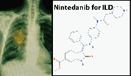 Emerging Strategies in the Diagnosis and Treatment of Interstitial Lung Disease (ILD) Emerging Strategies in the Diagnosis and Treatment of Interstitial Lung Disease (ILD)