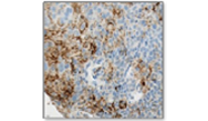 Immunotherapy with Anti-PD-1/PD-L1 Agents Are New Effective Therapies for Recurring and/or Metastatic Squamous Cell Carcinoma of the Head and Neck Immunotherapy with Anti-PD-1/PD-L1 Agents Are New Effective Therapies for Recurring and/or Metastatic Squamous Cell Carcinoma of the Head and Neck