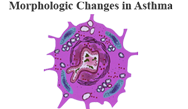 Emerging Interleukin-5 (IL-5) or its Receptor (IL-5R) Monoclonal Antibody Based Biological Therapies for Severe or Poorly Controlled Asthma Emerging Interleukin-5 (IL-5) or its Receptor (IL-5R) Monoclonal Antibody Based Biological Therapies for Severe or Poorly Controlled Asthma
